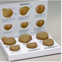 Prostate Models
