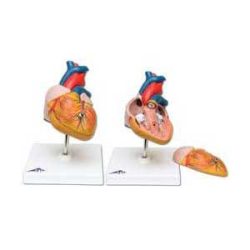 Human Heart Models
